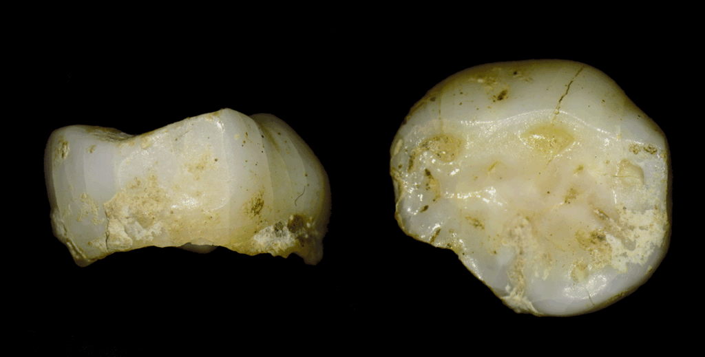 foto al microscopio ottico del dente da latte del bambino di pradis, di colore avorio e screziature ocra